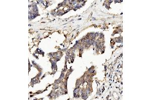 IHC analysis of Ribonuclease Inhibitor/RNH1 using anti-Ribonuclease Inhibitor/RNH1 antibody (ABIN7603117). (RNH1 anticorps  (N-Term))