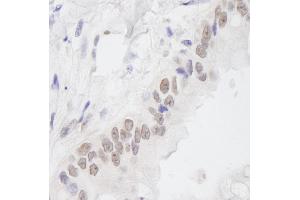 Immunohistochemistry (IHC) image for anti-Chromosome 11 Open Reading Frame 30 (C11orf30) (C-Term) antibody (ABIN7448552)