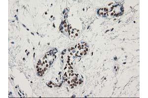 Immunohistochemical staining of paraffin-embedded Human breast tissue using anti-LENG1 mouse monoclonal antibody. (Leng1 anticorps)