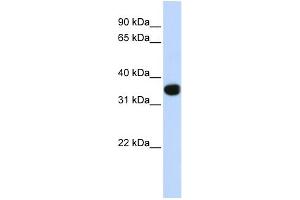 WB Suggested Anti-TLX1 Antibody Titration:  0. (TLX1 anticorps  (Middle Region))