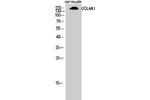 Western Blotting (WB) image for anti-Collagen, Type IV, alpha 1 (COL4A1) (N-Term) antibody (ABIN5956219) (COL4A1 anticorps  (N-Term))