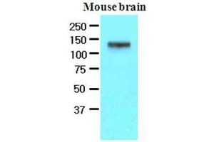 The extracts of mouse brain (50 ug) were resolved by SDS-PAGE, transferred to nitrocellulose membrane and probed with anti-human EphA2 (1:500).