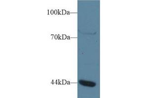 Western Blot; Sample: Human Jurkat cell lysate; Primary Ab: 1µg/ml Rabbit Anti-Human GTF3A Antibody Second Ab: 0. (GTF3A anticorps  (AA 71-365))