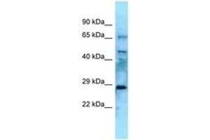 Image no. 1 for anti-Eyes Absent Homolog 4 (EYA4) (N-Term) antibody (ABIN6748312) (EYA4 anticorps  (N-Term))
