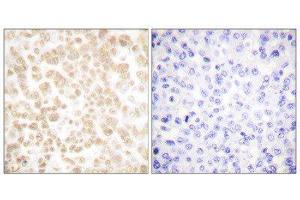 Immunohistochemistry (IHC) image for anti-FOS-Like Antigen 2 (FOSL2) (C-Term) antibody (ABIN1848552) (FOSL2 anticorps  (C-Term))