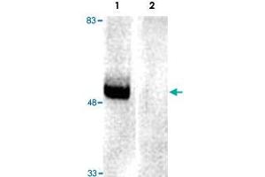 PARK2 immunoreactivity of rat brain extracts and immunobloted with PARK2 polyclonal antibody  . (Parkin anticorps)