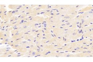 Detection of VAV1 in Mouse Cardiac Muscle Tissue using Polyclonal Antibody to Vav 1 Oncogene (VAV1) (VAV1 anticorps  (AA 565-795))