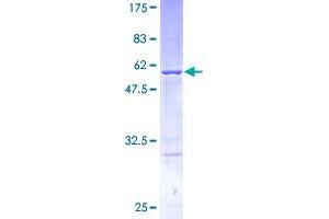 Image no. 1 for Tumor Protein D52 (TPD52) (AA 1-184) protein (GST tag) (ABIN1323409)