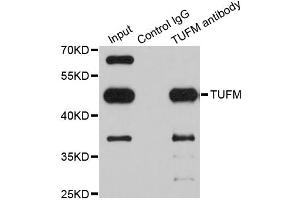 Immunoprecipitation analysis of 200ug extracts of Jurkat cells using 1ug TUFM antibody. (TUFM anticorps)
