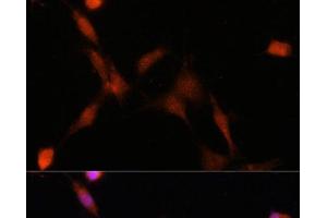 Immunofluorescence analysis of NIH-3T3 cells using PSMA7 Polyclonal Antibody at dilution of 1:100.