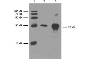 anti-His Tag antibody