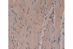 Used in DAB staining on fromalin fixed paraffin- embedded rectum tissue