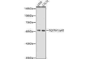 Western blot analysis of extracts of various cell lines, using SQSTM1/p62 antibody (ABIN7270205) at 1:1000 dilution.