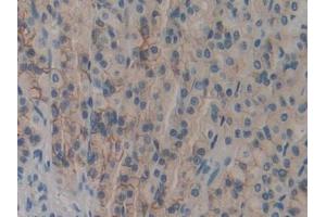 DAB staining on IHC-P; Samples: Rat Stomach Tissue (DOK7 anticorps  (AA 63-320))