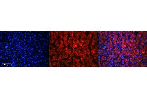 Rabbit Anti-SLC37A4 Antibody      Formalin Fixed Paraffin Embedded Tissue: Human Adult Liver   Observed Staining: Cytoplasm in hepatocytes, moderate tissue distribution  Primary Antibody Concentration: 1:100  Secondary Antibody: Donkey anti-Rabbit-Cy3  Secondary Antibody Concentration: 1:200  Magnification: 20X  Exposure Time: 0.
