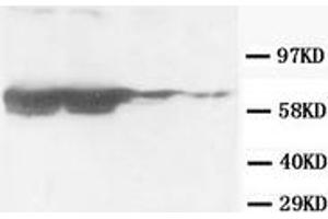 Western Blotting (WB) image for anti-Glial Fibrillary Acidic Protein (GFAP) antibody (ABIN1107345) (GFAP anticorps)