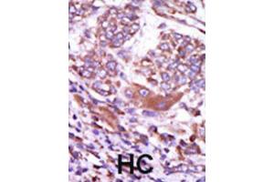 Immunohistochemistry (IHC) image for anti-Calcium/calmodulin-Dependent Protein Kinase II delta (CAMK2D) antibody (ABIN5023065) (CAMK2D anticorps)