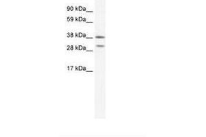 Image no. 1 for anti-NK2 Homeobox 3 (NKX2-3) (AA 34-83) antibody (ABIN202180) (NK2 Homeobox 3 anticorps  (AA 34-83))