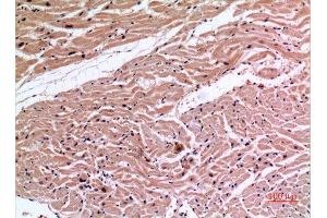 Immunohistochemistry (IHC) analysis of paraffin-embedded Human Heart, antibody was diluted at 1:100. (XRCC6 anticorps  (Ser402))
