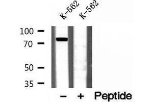 Western blot analysis of extracts of K-562 cells, using Coilin antibody. (Coilin anticorps  (Internal Region))