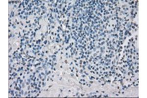 Image no. 5 for anti-Protein Phosphatase 5, Catalytic Subunit (PPP5C) antibody (ABIN1500390)