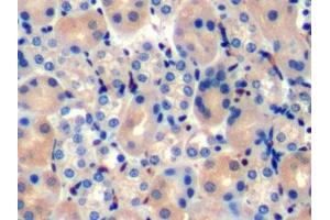 Detection of TAN1 in Mouse Kidney Tissue using Polyclonal Antibody to Translocation Associated Notch Homolog 1 (TAN1)