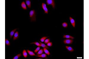 MCF-7 cells were stained with DLG1+3 Polyclonal Antibody, Unconjugated at 1:500 in PBS and incubated for two hours at 37°C followed by Goat Anti-Rabbit IgG (H+L) Cy3 conjugated secondary antibody. (DLG3 anticorps  (AA 501-600))