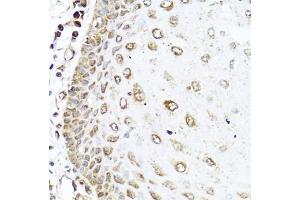 Immunohistochemistry of paraffin-embedded human esophagus using RAC2 antibody (ABIN5970487) at dilution of 1/100 (40x lens). (RAC2 anticorps)