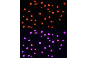 Immunofluorescence analysis of L929 cells using KA Rabbit pAb (ABIN1679964, ABIN5664011, ABIN5664013 and ABIN6219456) at dilution of 1:100 (40x lens).