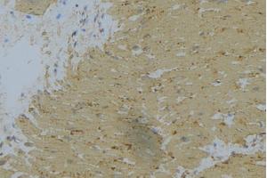 ABIN6269398 at 1/100 staining Mouse muscle tissue by IHC-P. (WNK1 anticorps  (N-Term))
