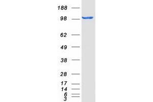 Validation with Western Blot