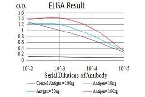 Black line: Control Antigen (100 ng),Purple line: Antigen (10 ng), Blue line: Antigen (50 ng), Red line:Antigen (100 ng) (IGLC2 anticorps  (AA 1-106))