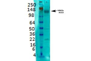 Western Blot analysis of Rat brain membrane lysate showing detection of KCC2 protein using Mouse Anti-KCC2 Monoclonal Antibody, Clone S1-12 . (KCC2 anticorps  (AA 932-1043) (Biotin))