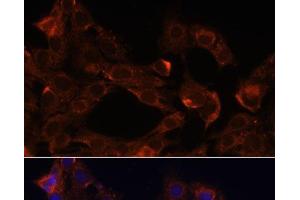 Immunofluorescence analysis of C6 cells using NRP1 Polyclonal Antibody at dilution of 1:100. (Neuropilin 1 anticorps)