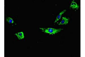 Immunofluorescent analysis of Hela cells using ABIN7168509 at dilution of 1:100 and Alexa Fluor 488-congugated AffiniPure Goat Anti-Rabbit IgG(H+L) (RYR2 anticorps  (AA 901-1192))