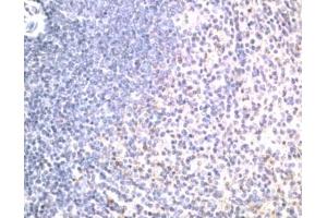 Immunohistochemistry (IHC) image for anti-Tumor Necrosis Factor Receptor Superfamily, Member 10b (TNFRSF10B) (Extracellular Domain) antibody (ABIN342736)