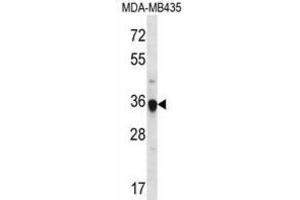 Western Blotting (WB) image for anti-Fibrinogen-Like 1 (FGL1) antibody (ABIN2996869) (FGL1 anticorps)