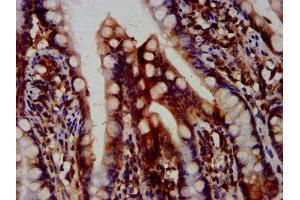 IHC image of ABIN7162338 diluted at 1:400 and staining in paraffin-embedded human small intestine tissue performed on a Leica BondTM system.