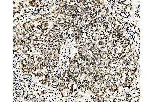 IHC analysis of RCC1 using anti-RCC1 antibody (ABIN7600024). (RCC1 anticorps  (AA 14-421))