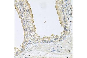 Immunohistochemistry of paraffin-embedded human prostate using ANKH antibody. (ANKH anticorps)
