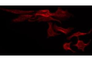 ABIN6274945 staining HeLa by IF/ICC. (ABCC3 anticorps  (Internal Region))
