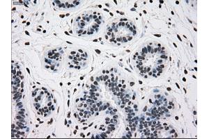 Immunohistochemical staining of paraffin-embedded breast tissue using anti-TYRO3 mouse monoclonal antibody. (TYRO3 anticorps)