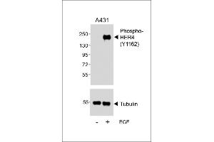 Western blot analysis of lysates from A431 cell line, untreated or treated with EGF, 100 ng/mL, using (ABIN389572 and ABIN2839598) (upper) or Tubulin (lower). (ERBB4 anticorps  (pTyr1162))