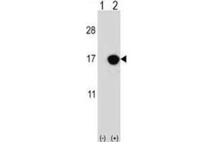 Western Blotting (WB) image for anti-Cyclin-Dependent Kinase Inhibitor 2B (p15, Inhibits CDK4) (CDKN2B) antibody (ABIN2996859) (CDKN2B anticorps)