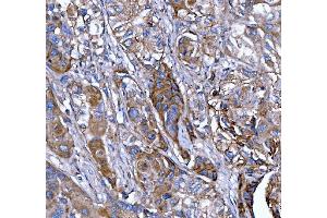 IHC analysis of Kindlin 2/FERMT2 using anti-Kindlin 2/FERMT2 antibody (ABIN7599515). (FERMT2 anticorps  (AA 1-650))