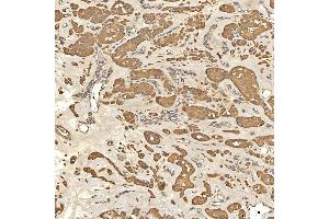 IHC analysis of Citrin/SLC25A13 using anti-Citrin/SLC25A13 antibody (ABIN7599512). (slc25a13 anticorps  (AA 1-643))