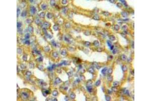 Used in DAB staining on fromalin fixed paraffin-embedded Kidney tissue