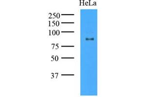 Western Blotting (WB) image for anti-K(lysine) Acetyltransferase 2A (KAT2A) (AA 411-837) antibody (ABIN487349) (KAT2A anticorps  (AA 411-837))