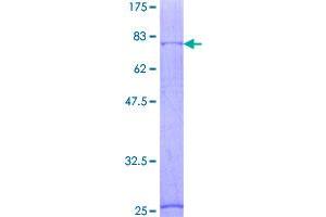 Image no. 1 for gamma-aminobutyric Acid (GABA) A Receptor, alpha 1 (GABRA1) (AA 1-456) protein (GST tag) (ABIN1354645)