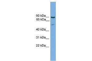 Cornulin antibody used at 1 ug/ml to detect target protein. (CRNN anticorps  (Middle Region))